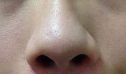 Front of Nose (After using product)