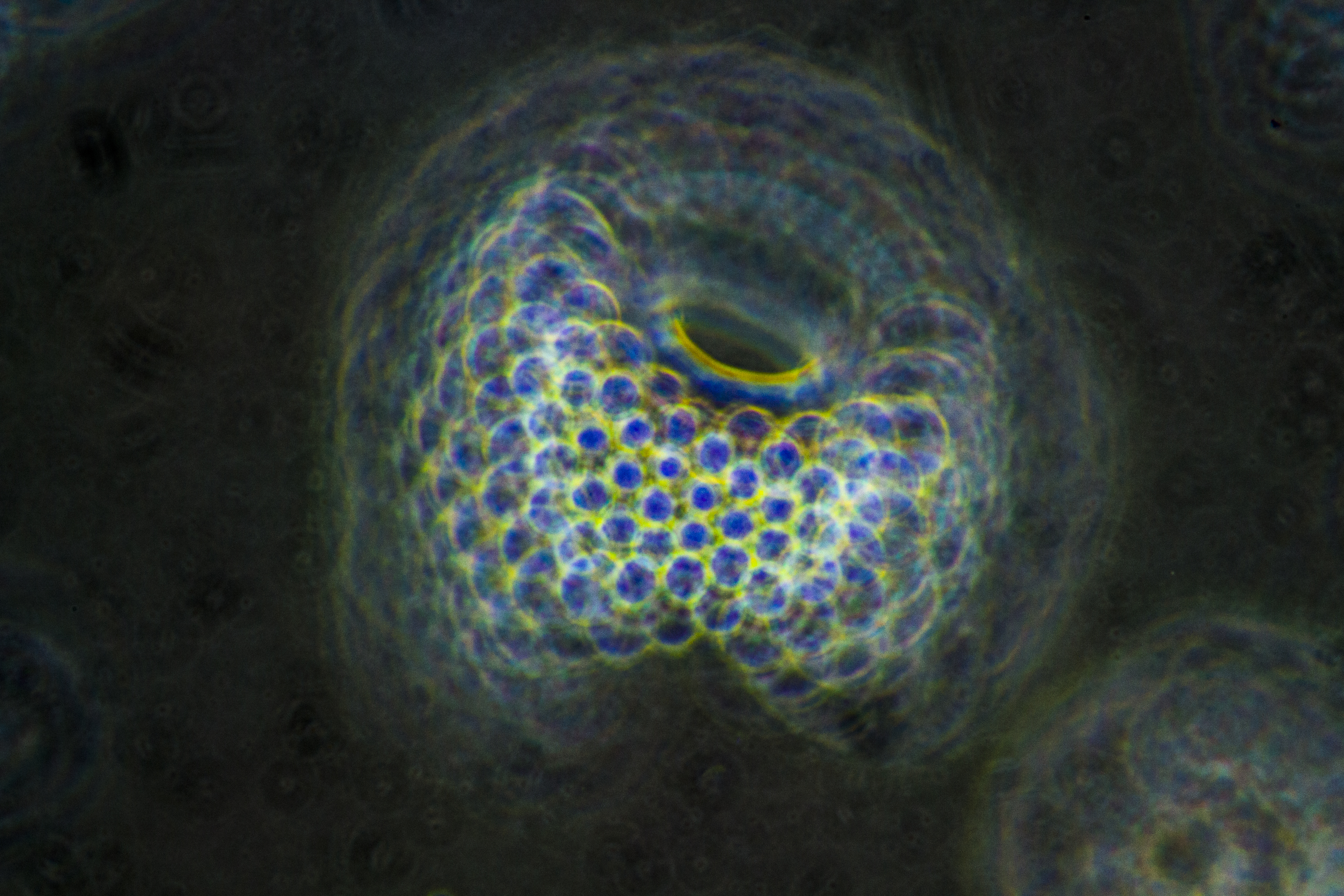 Radiolaria0302.JPG
