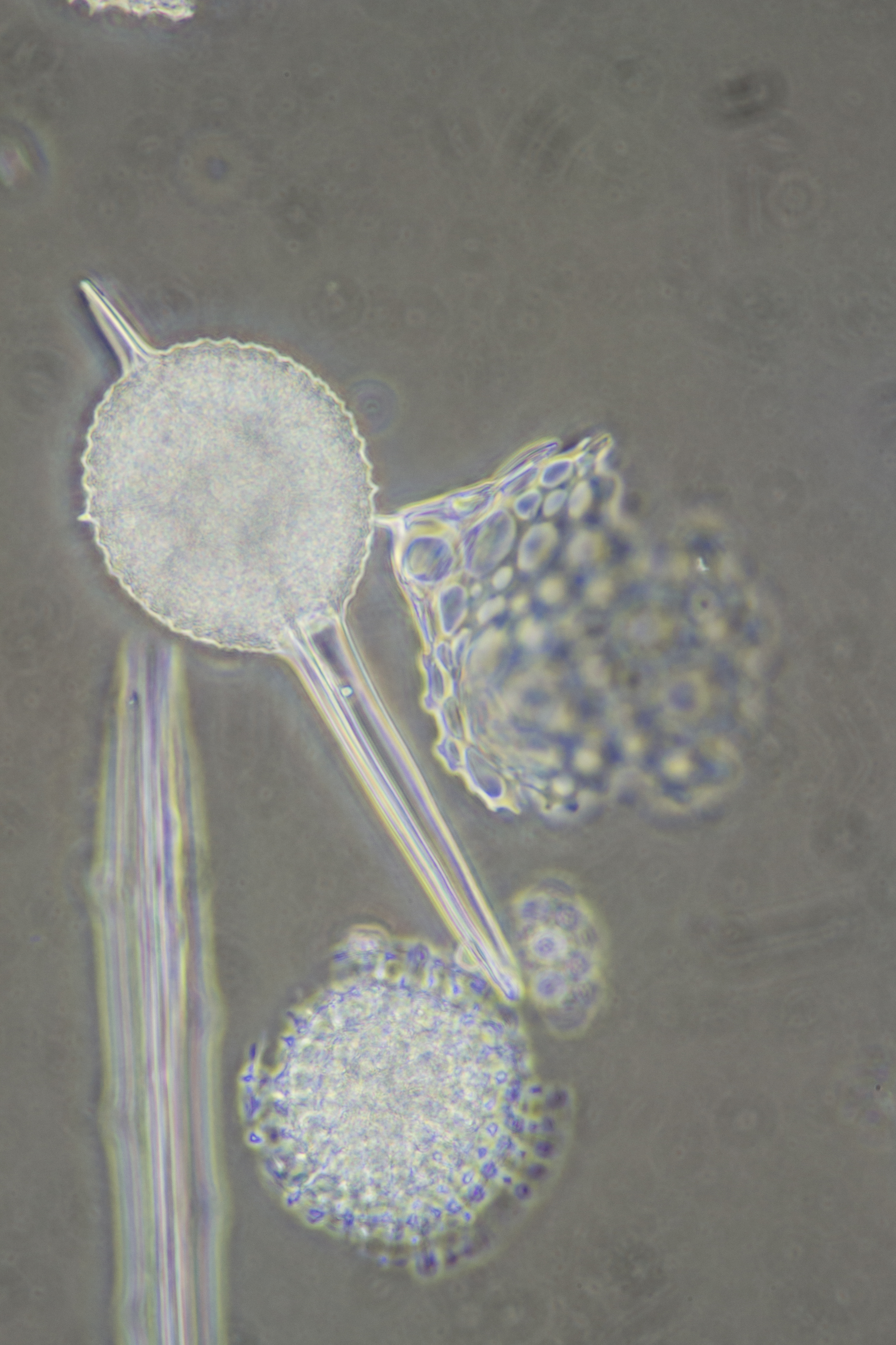 Radiolaria1607.JPG
