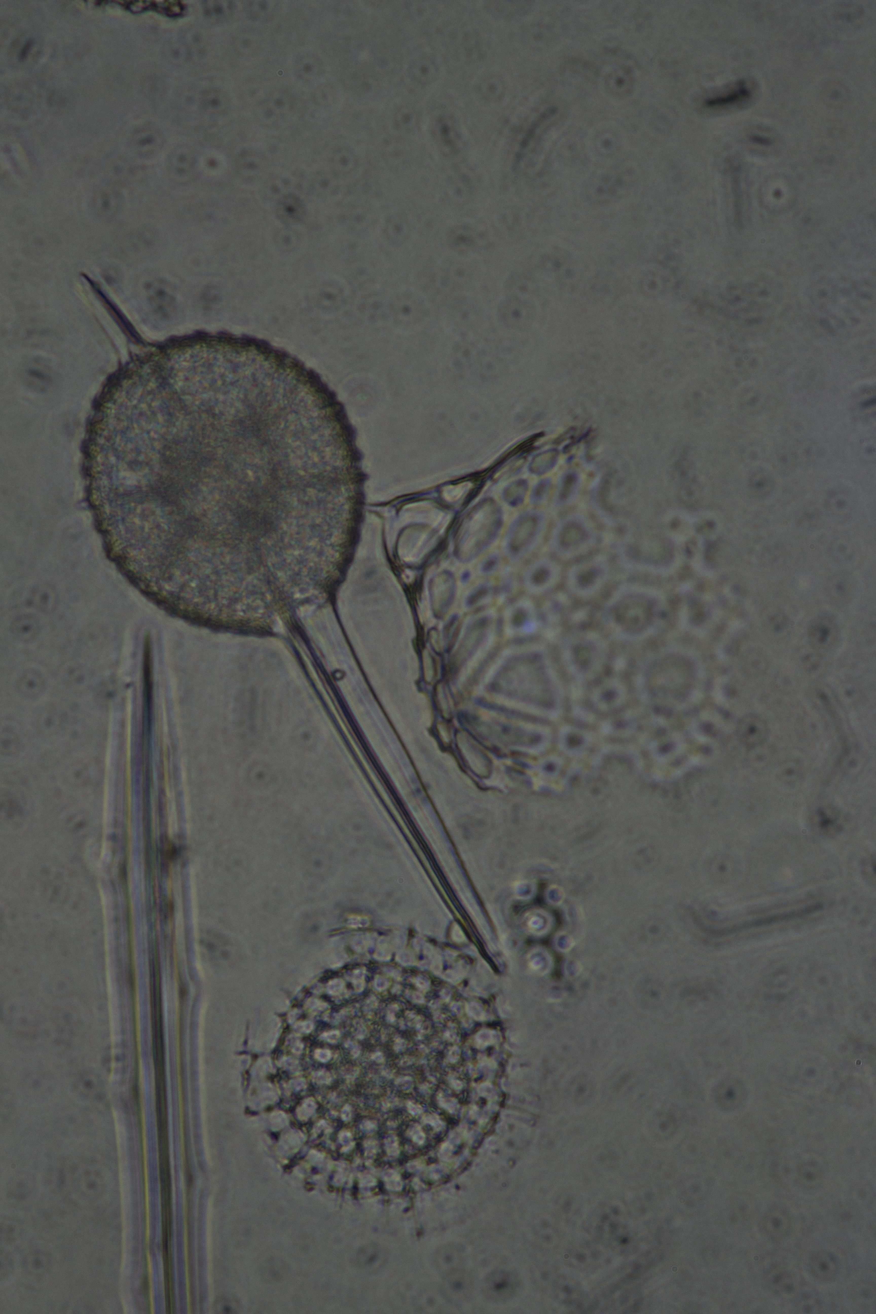 Radiolaria1506.JPG