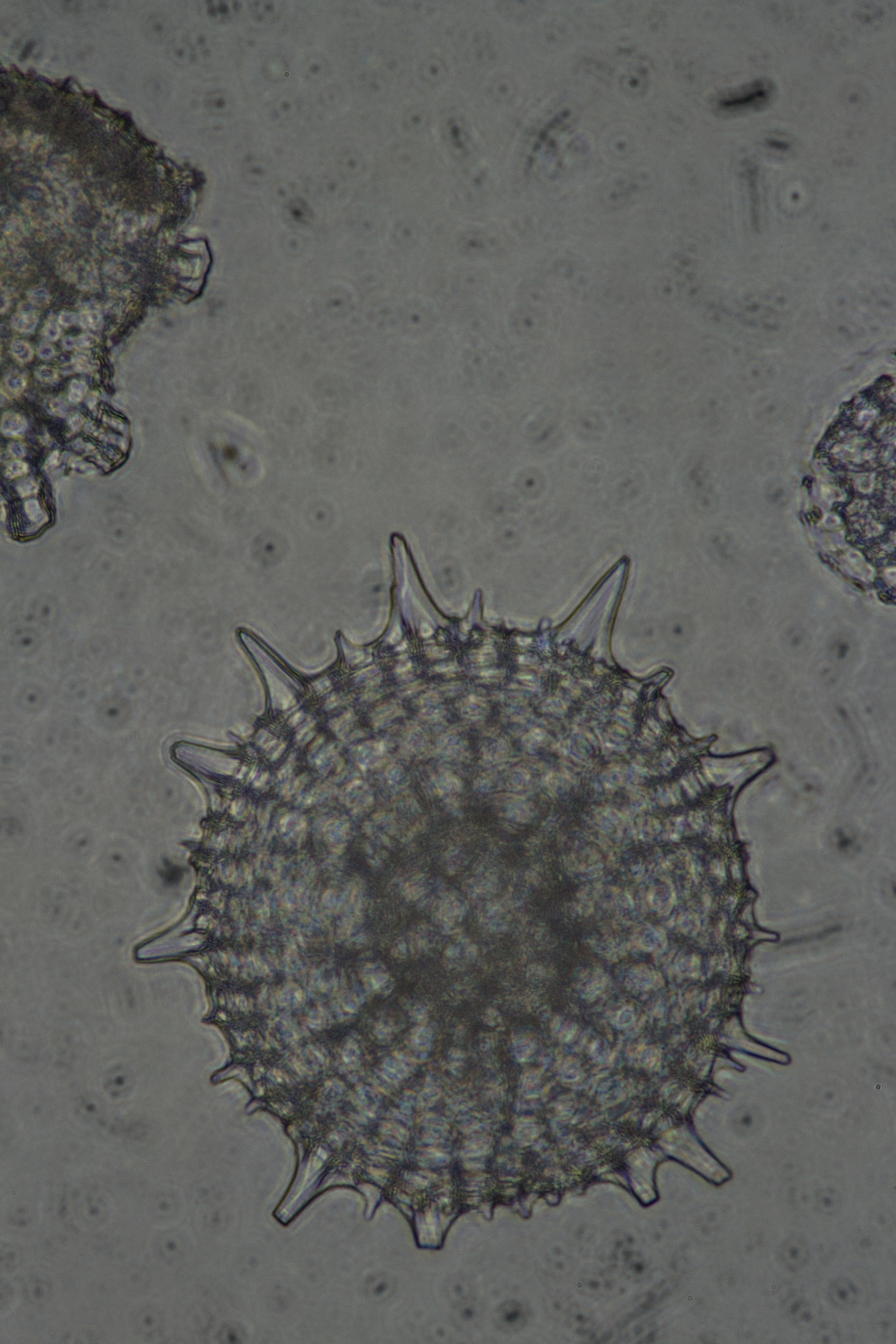 Radiolaria1004.JPG