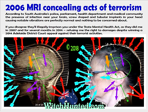 MRI A Terrorists MINNIS and LOFTUS join.png