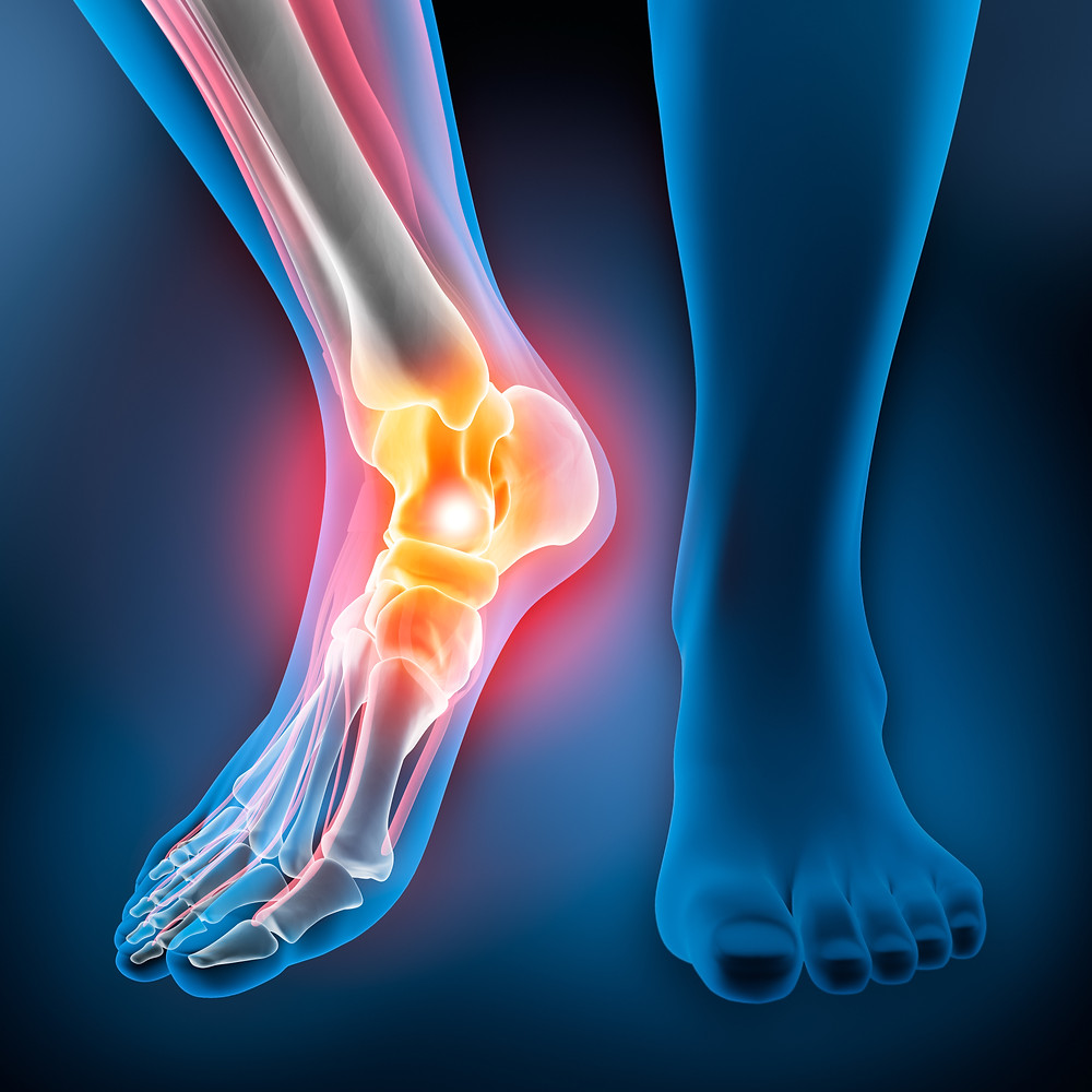 Ankle Injuries from auto accident and slip and fall accident