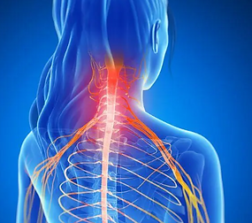 neck pain radciulopathy.png