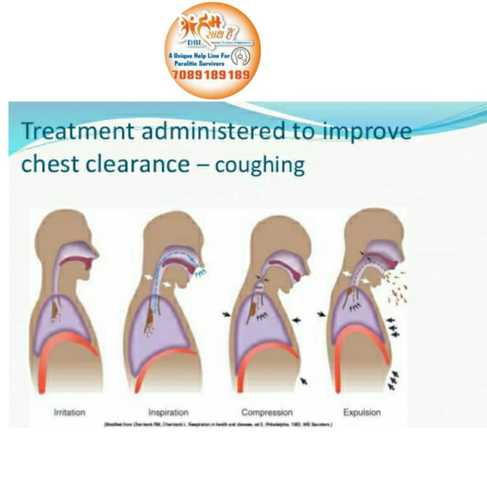 COUGHING AND HUFFING TECHNIQUE