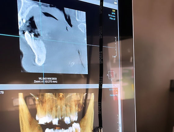 Gaziantep Diş Hekimi Buket Çikolar