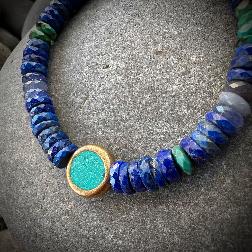 Thumbnail: The Grounding Bracelet