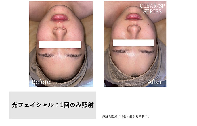 ef_facial-17.jpg