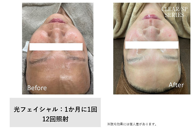 ef_facial-10.jpg