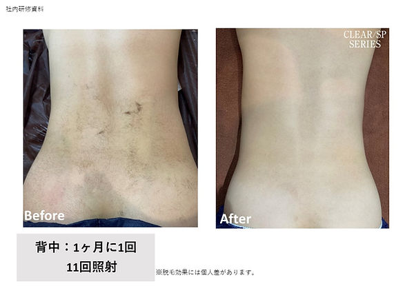 body_baaward (1).jpg