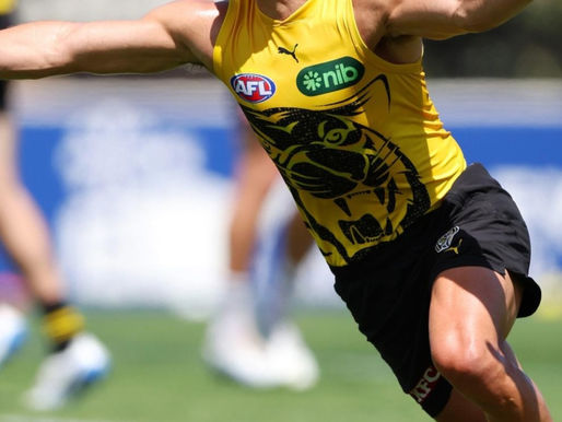 What Could Dion Prestia’s 2026 Calf Setback Change About His Richmond Role?
