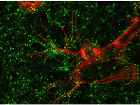 CITED-2 Protein Tackles Hypoxic Response in the Retina
