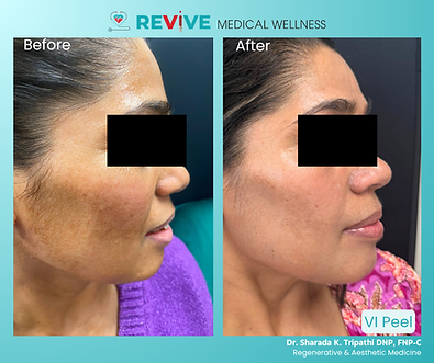 Before and After Pictures Template (5).png