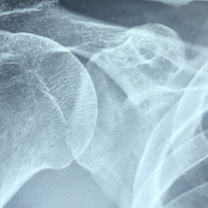 Understanding Pain: A New Way to Think About It and How It Can Help You Feel Better