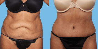 Hotels-Models14015 2_edit_new 2.jpg