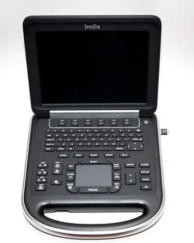 Sonosite Edge