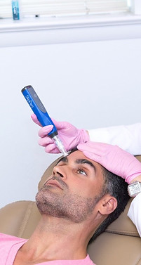 Microneedling-Men.jpg