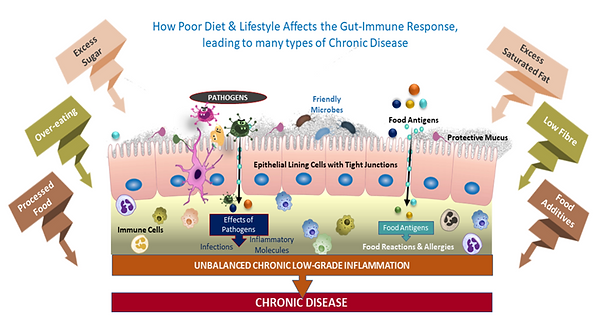 Picture1-gut-imbalance-can-lead-to-chronic-disease.png