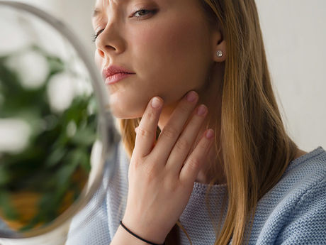 What Acne Leaves Behind: The Difference Between Dark Marks and True Scars
