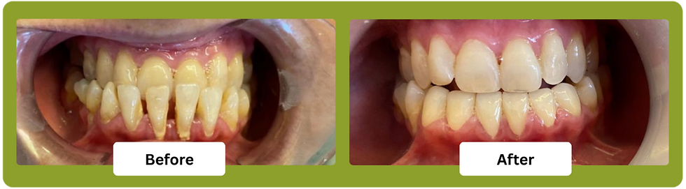 Cherico blog creatives (10)_edited.png