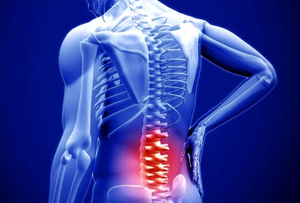 Low Back Pain