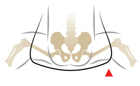 מפרקי התינוק כאשר הוא בתנוחת צפרדע הבריאה