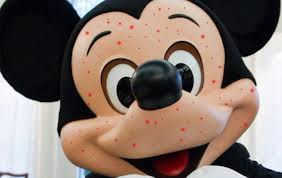 La vacuna contra el sarampión es muy efectiva...