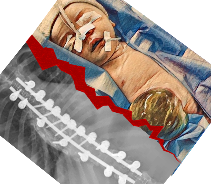 Chirurgie Pédiatrique