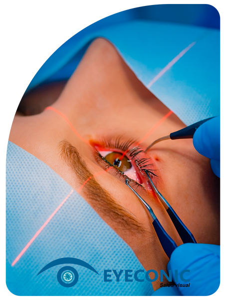 CIRUGÍA LASIK.png