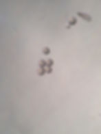 Egg Cells (marginalis)