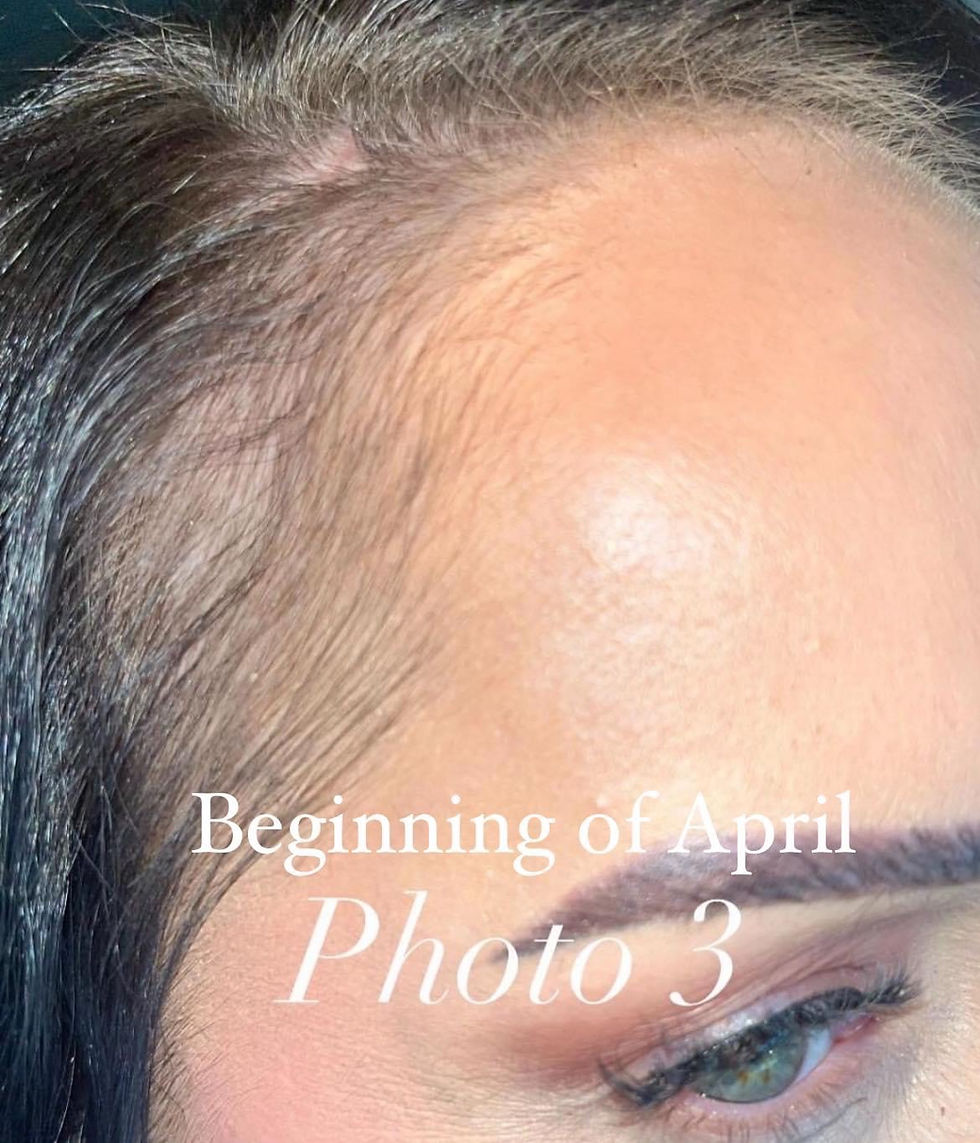 Thumbnail: Hair ReGrowth Oil