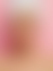 Ross Monasterios. Claves para corregir tus ojeras