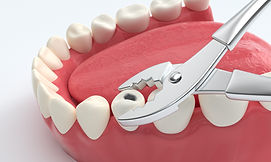 3d-render-jaw-with-teeth-dental-incisor-implant-white-background.jpg
