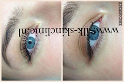 wimperlift 