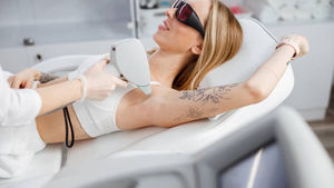 Radiant Smoothness: The Ultimate Guide to Laser Hair Removal