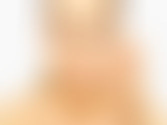 Enhancing Beauty: The Trend of Russian Lip Fillers in Riyadh