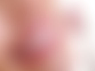 Bright Smiles in Riyadh: A Comprehensive Guide to Teeth Whitening