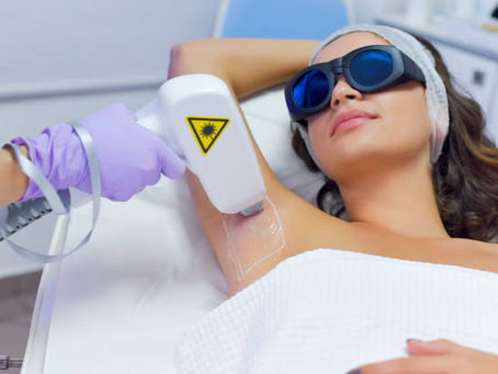 Unveiling the Smooth: The Ultimate Guide to Laser Hair Removal