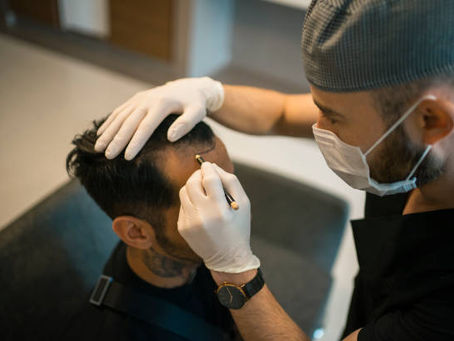 The Ultimate Guide to Hair Transplants: Everything You Need to Know