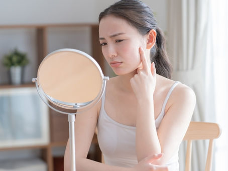 炎症肌は今始めると差がつく、春ケア