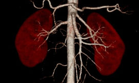 aortagram 3d_edited.jpg