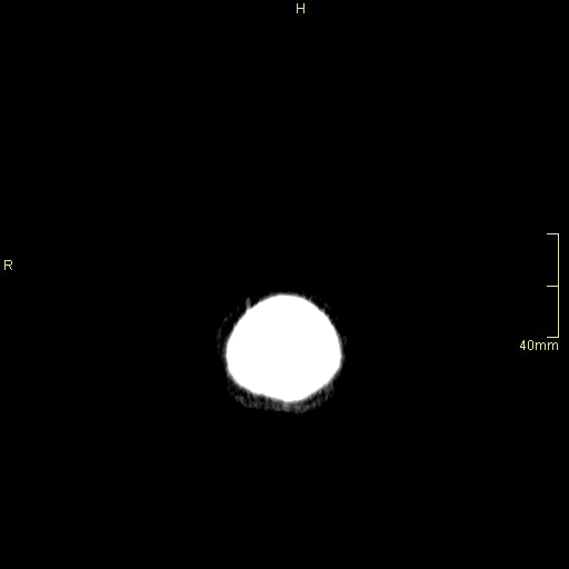 coronal.gif