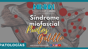 Síndrome miofascial: puntos gatillo