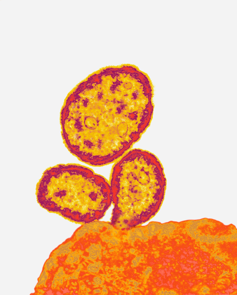 Micro No. 85
