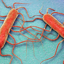 PENGUJIAN CEPAT LISTERIA MONOCYTOGENES, SALAH SATU BAKTERI PENCEMAR MAKANAN