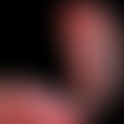 tubas uterinas e ovarios mostrando a fertilidade e riqueza do microbioma vaginal