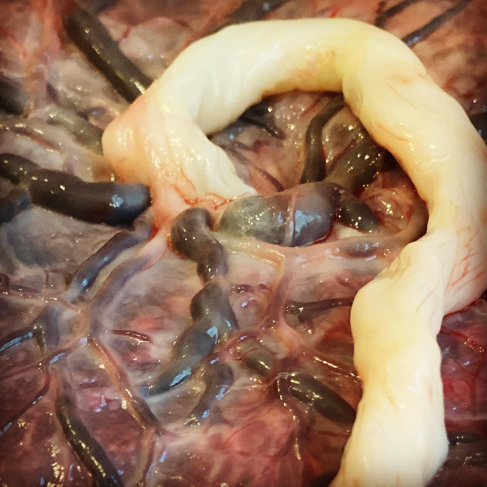 placenta, umbilical cord