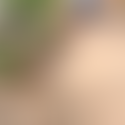 MORADORES DE BONSUCESSO CLAMAM POR MELHORIAS EM RUA