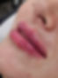 Modern lip treatment