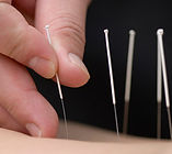 acupuncture.jpg